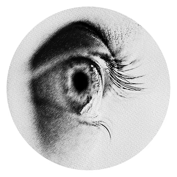 Other Eye Disorders