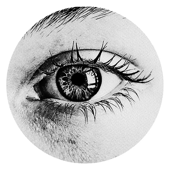 Refractive Errors