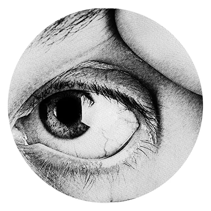 Retinal Disorders