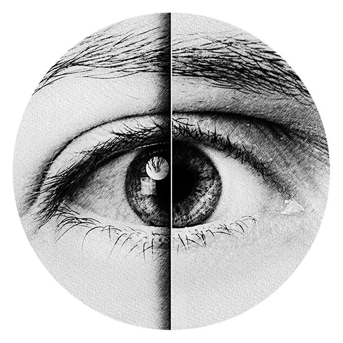 Dry Eye Disorders