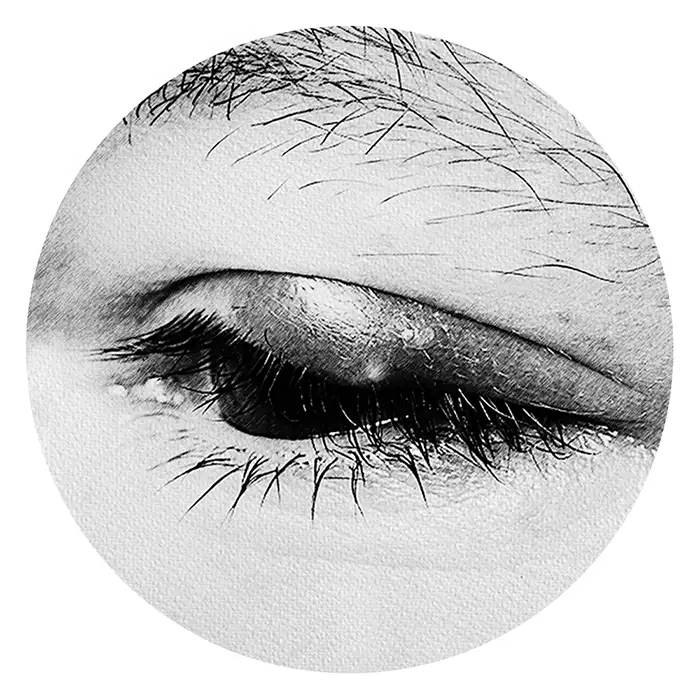 Eyelid Disorders