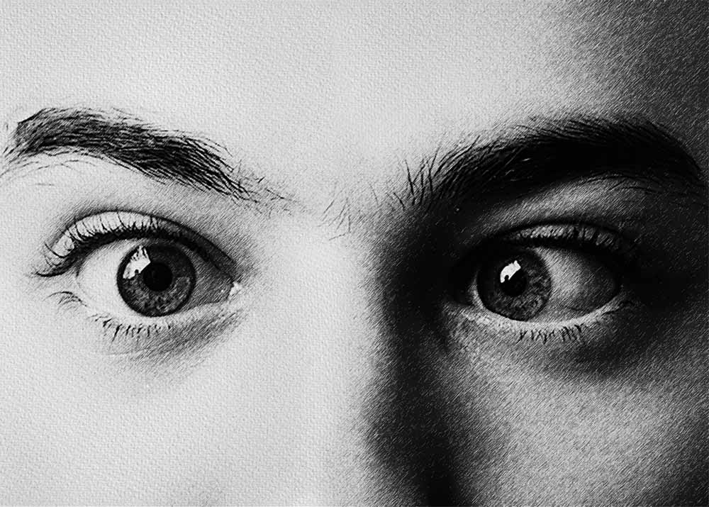 Amblyopia (Lazy Eye) (1) Amblyopia