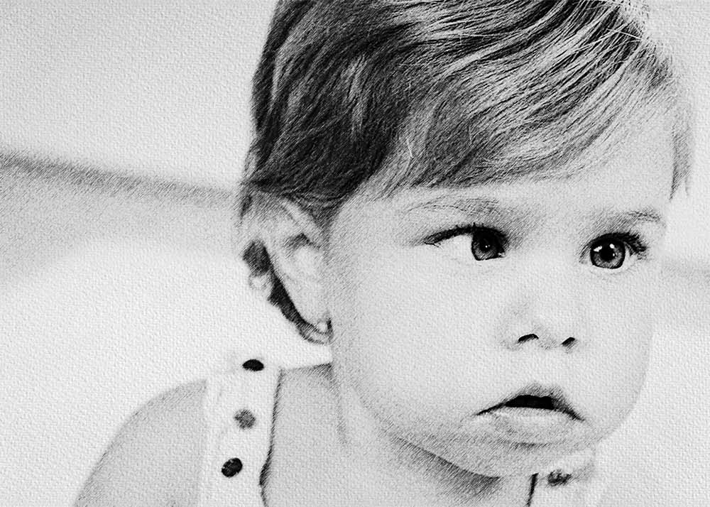 Amblyopia (Lazy Eye) (2) Amblyopia