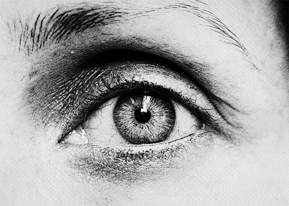 Astigmatism (2) Astigmatism