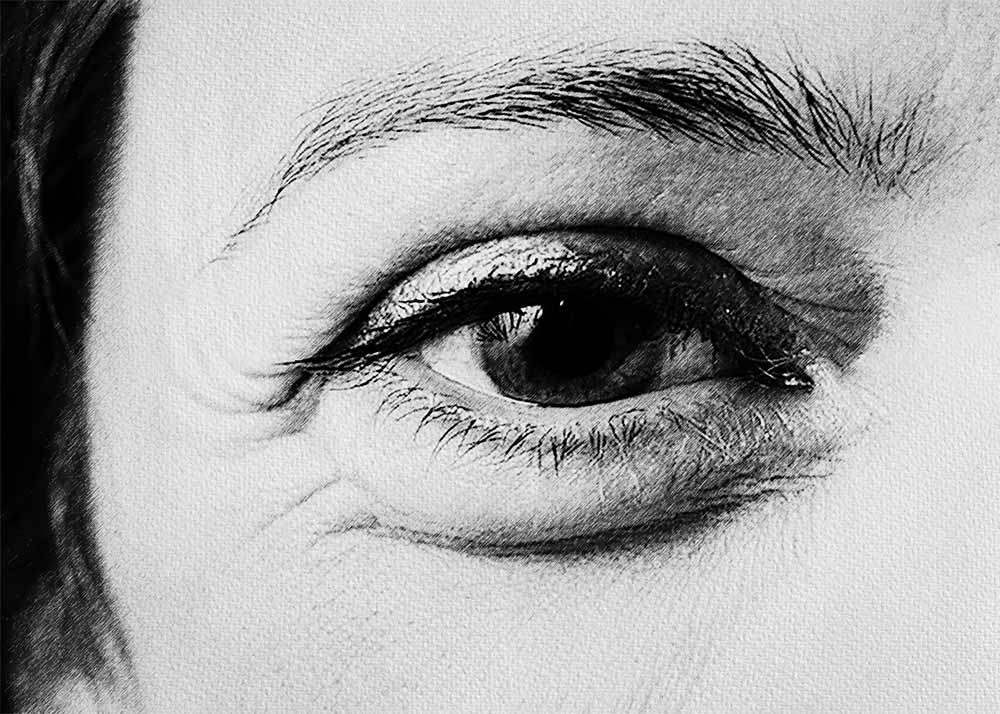Blepharospasm (3) Blepharospasm