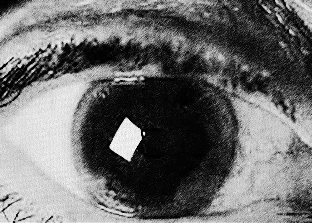 Cataracts (1) Cataracts
