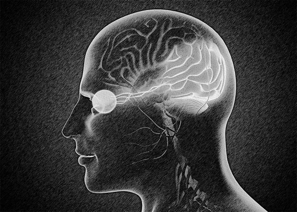 Cerebral Visual Impairment (CVI) (1) Cerebral Visual Impairment (CVI)