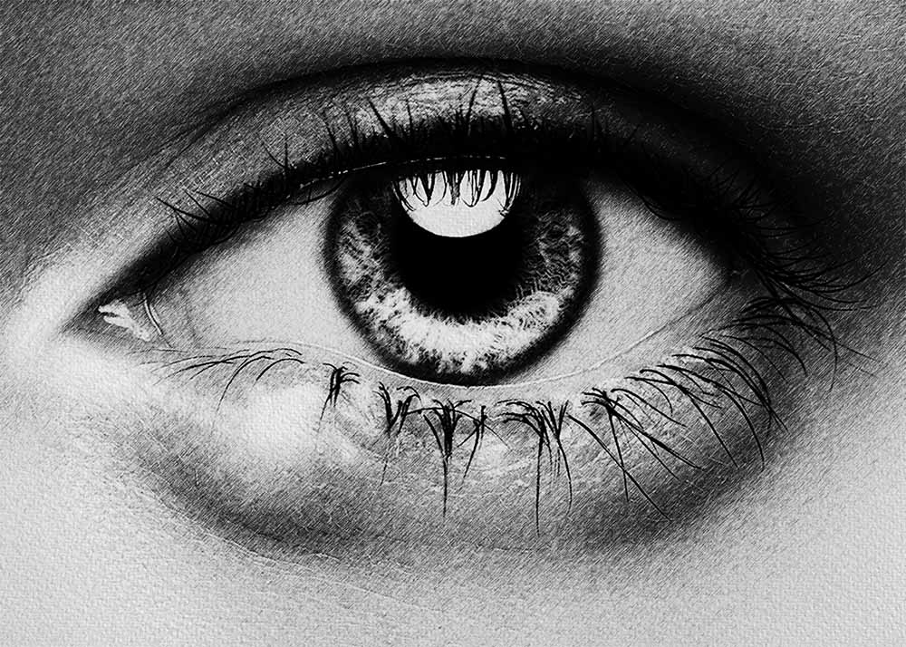 Chalazion