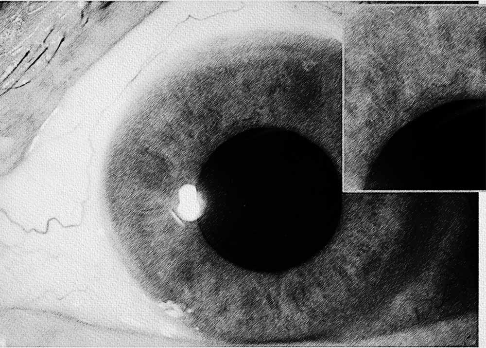 Diabetic glaucoma