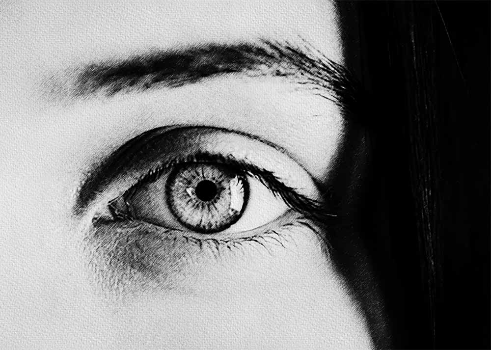 Glaucoma (4) Glaucoma