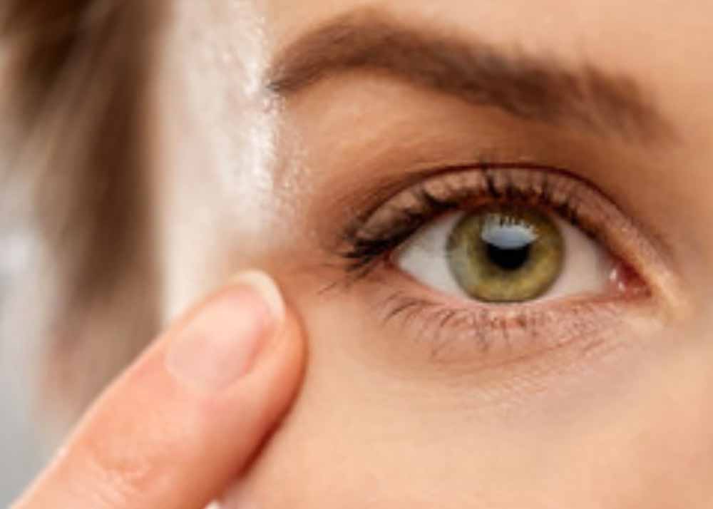 Hyperopia (Farsightedness) Hyperopia (Farsightedness)