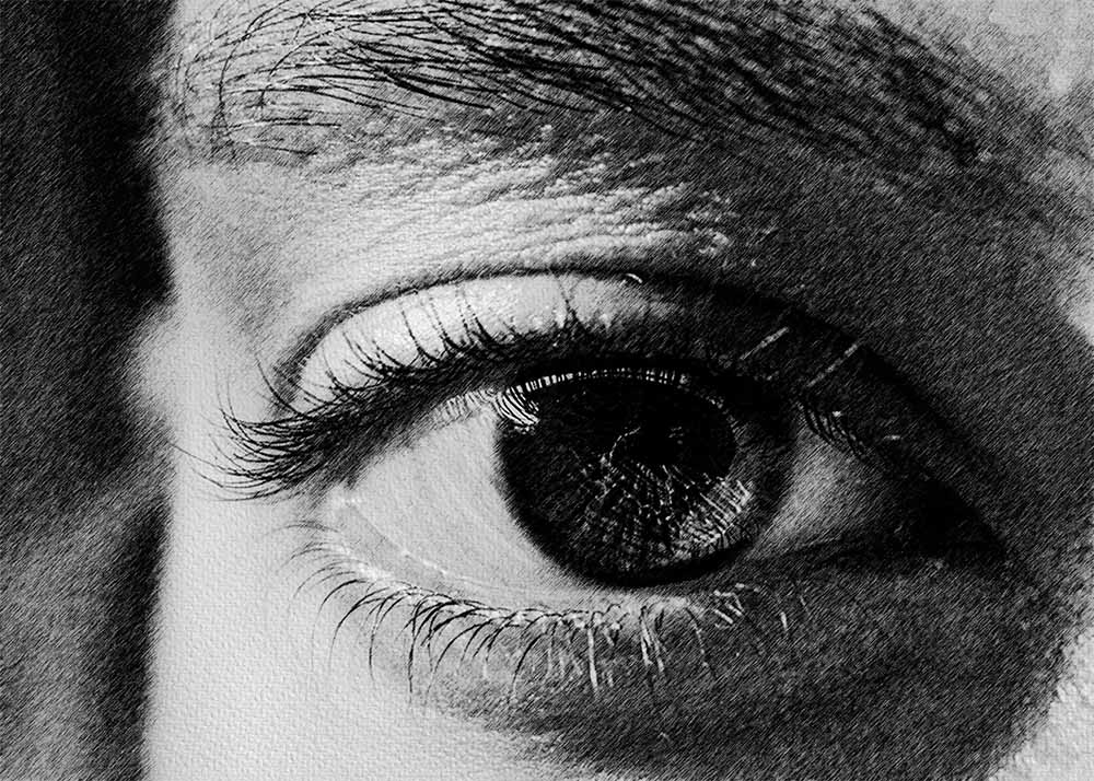 Hypertensive Retinopathy (2) Eye Cancer