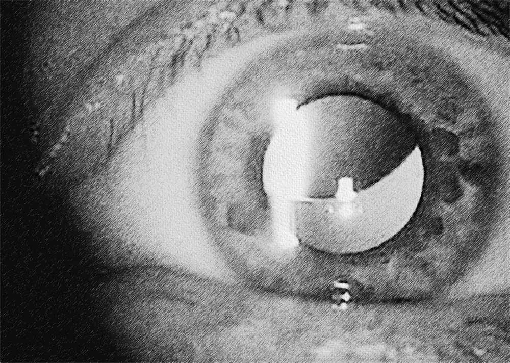 Lens Disorders (2) (1) Lens Disorders