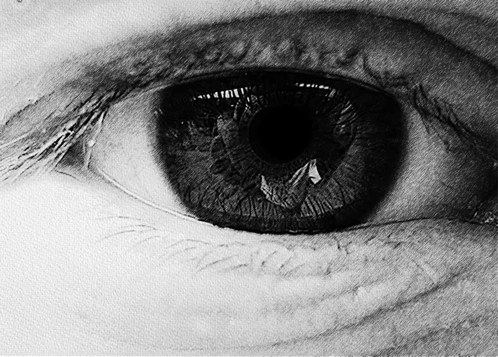 Macular Hole (4) Macular hole