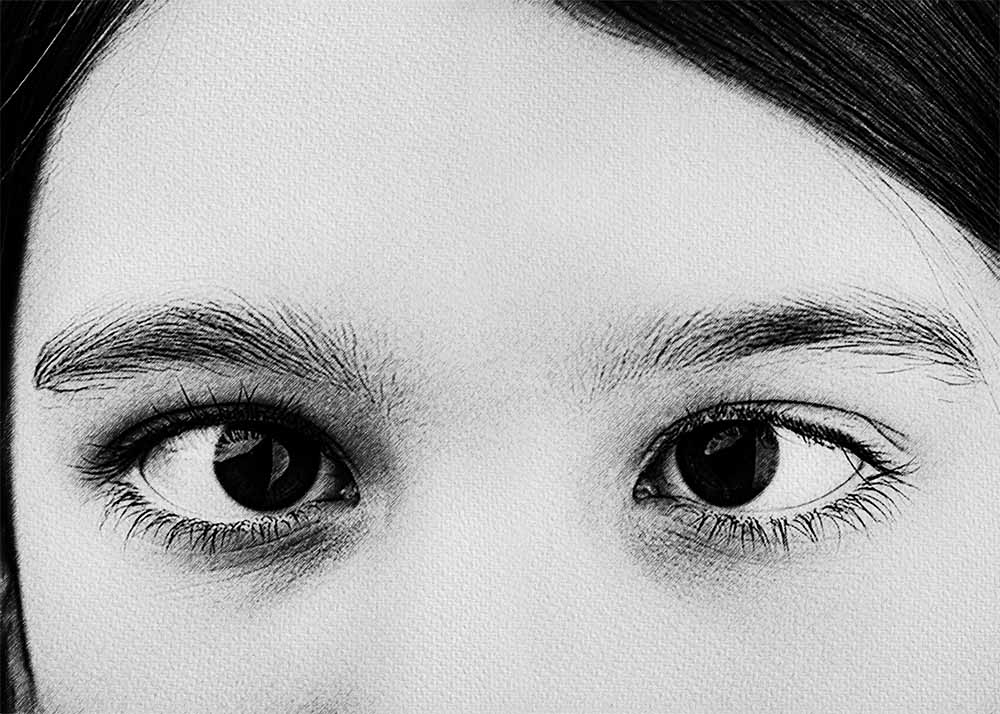 Nystagmus (2) Nystagmus