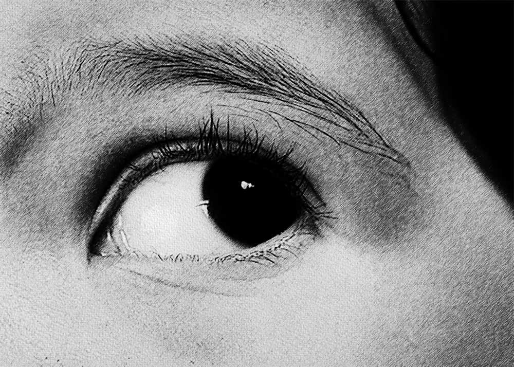 Nystagmus (3) Nystagmus