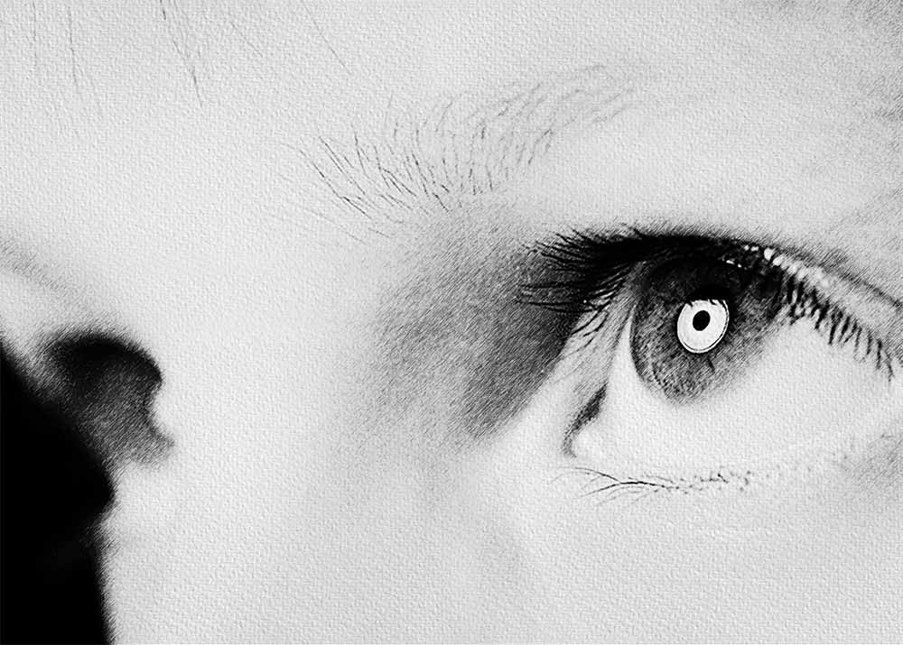 Nystagmus (4) Nystagmus