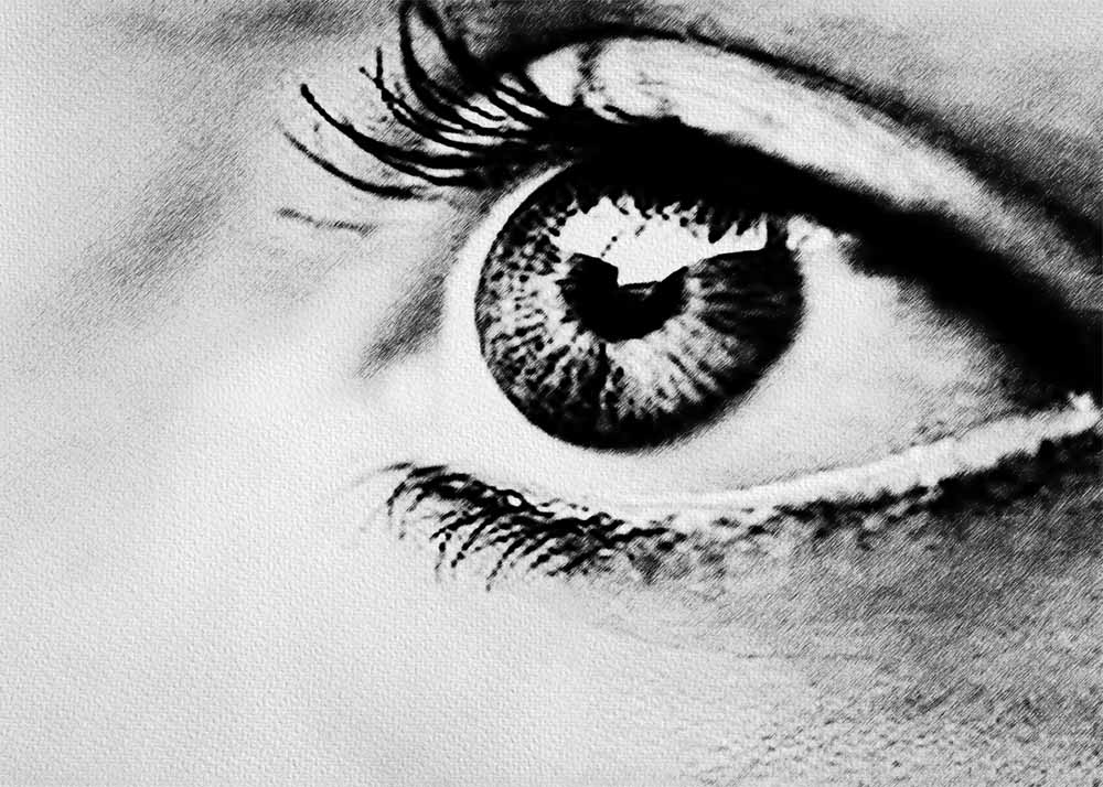 Ocular Migraine (3) Ocular Migraine