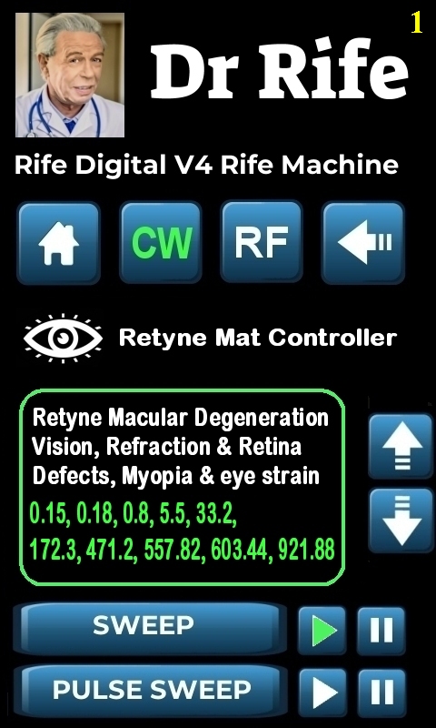 RDPV4 RETYNE SETTING_1