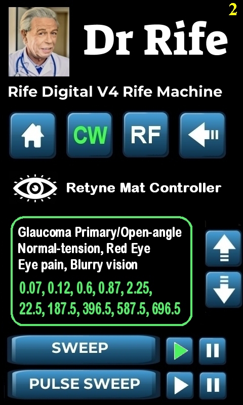 RDPV4 RETYNE SETTING_2