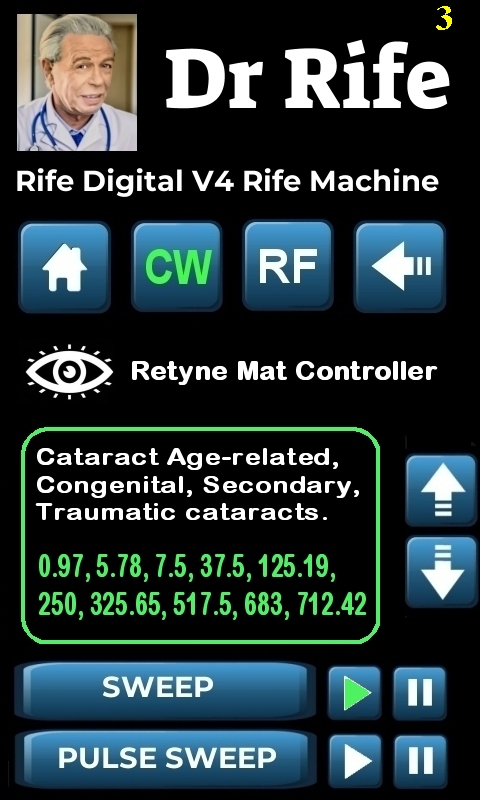 RDPV4 RETYNE SETTING_3 RDPV4 RETYNE SETTING_3