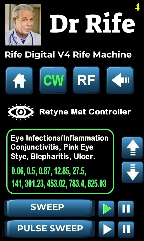 RDPV4 RETYNE SETTING_4