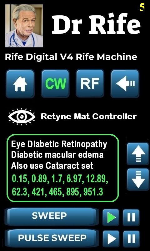 RDPV4 RETYNE SETTING_5