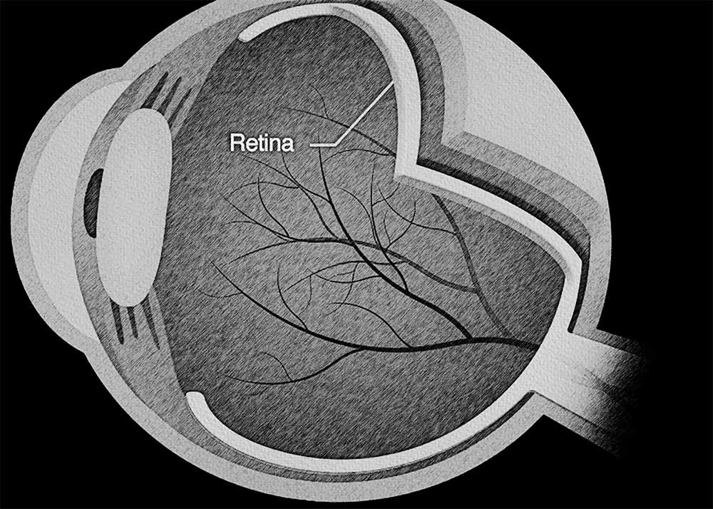 Retinal Disorders General