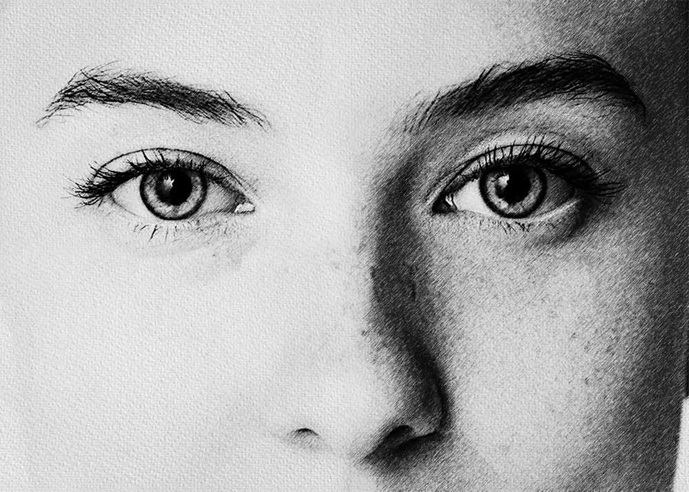 Scotoma (2) Scotoma