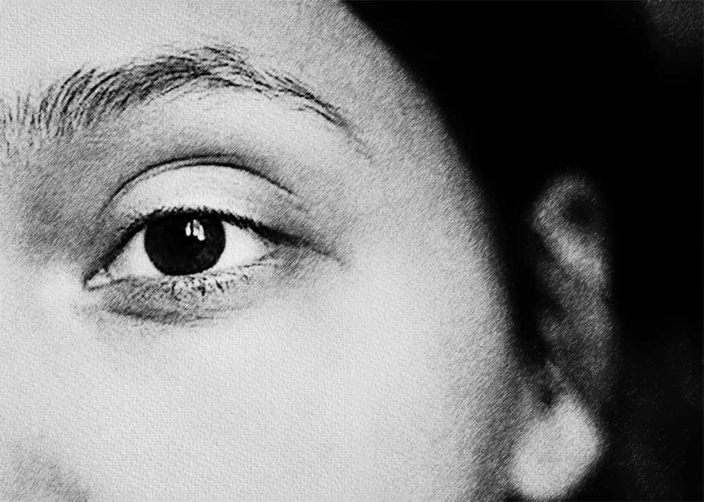 Scotoma (3) Scotoma