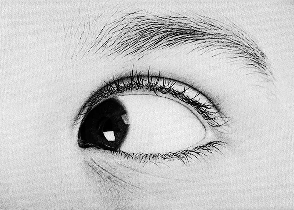 Strabismus (4) Strabismus