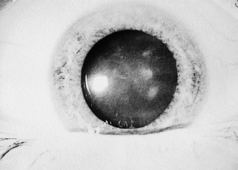 Traumatic cataract