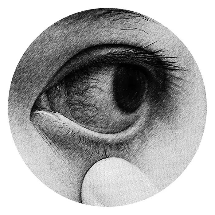 9. Infection & Inflammatory Eye Conditions